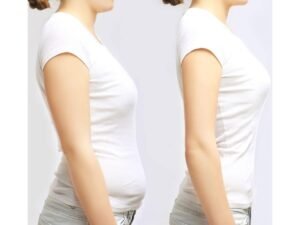 Antes y después corporal asociado al proceso de Hipno-Banda Gástrica para reprogramar la relación con la comida desde el subconsciente